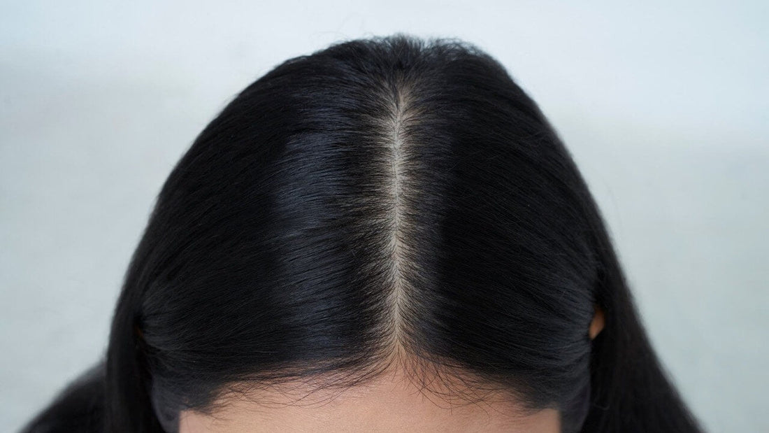healthy scalp tips