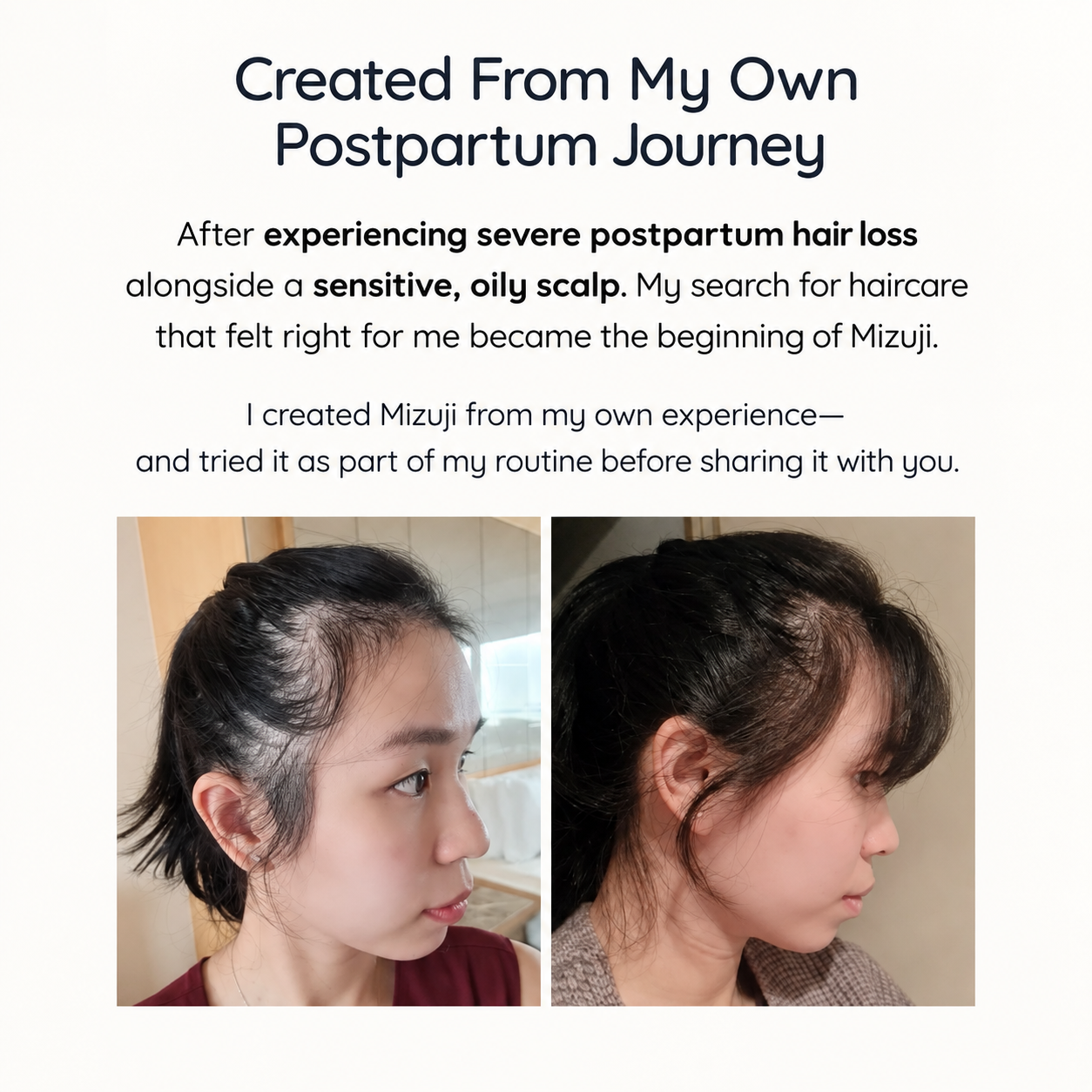 Scalp & Hair Essence - Hair Growth