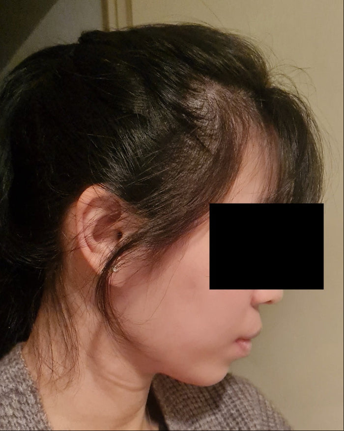 After ~2 months