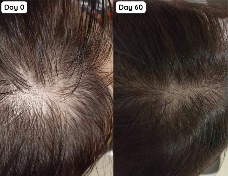 hair growth in 60 days